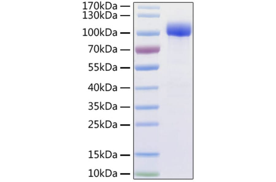SDS-PAGE - Recombinant Human ACE2 Protein (C-terminal His and Avi Tag) (A330067) - Antibodies.com