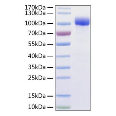 SDS-PAGE - Recombinant Human ACE2 Protein (C-terminal His and Avi Tag) (A330067) - Antibodies.com