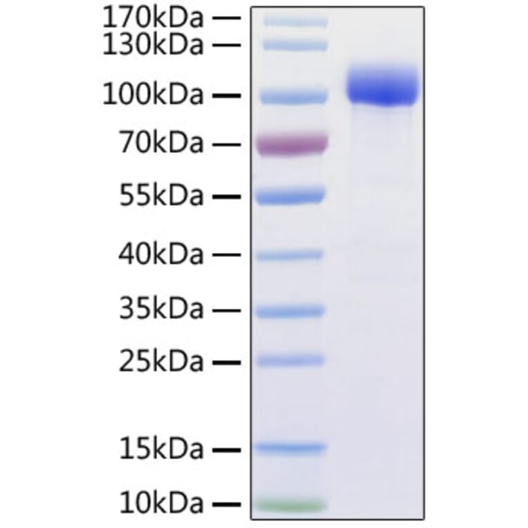 SDS-PAGE - Recombinant Human ACE2 Protein (C-terminal His and Avi Tag) (A330067) - Antibodies.com