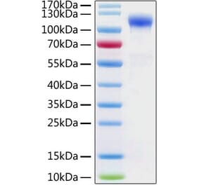 SDS-PAGE - Recombinant Human ACE2 Protein (N-terminal His Tag) (A330068) - Antibodies.com