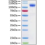SDS-PAGE - Recombinant Human ACE2 Protein (N-terminal His Tag) (A330068) - Antibodies.com
