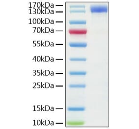 SDS-PAGE - Recombinant Human ACE2 Protein (C-terminal Human Fc Tag) (A330069) - Antibodies.com