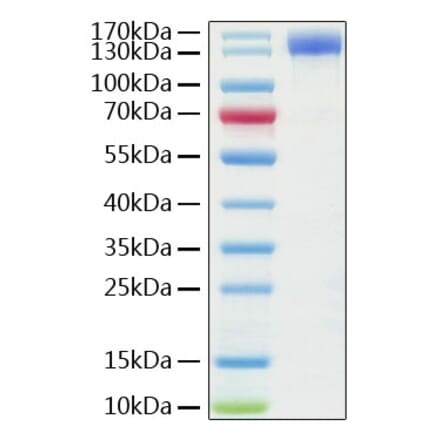SDS-PAGE - Recombinant Human ACE2 Protein (C-terminal Human Fc Tag) (A330069) - Antibodies.com
