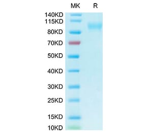 Tris-Bis PAGE - Recombinant Human ACE2 Protein (Biotin) (C-terminal His and Avi Tag) (A330070) - Antibodies.com