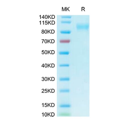 Tris-Bis PAGE - Recombinant Human ACE2 Protein (Biotin) (C-terminal His and Avi Tag) (A330070) - Antibodies.com