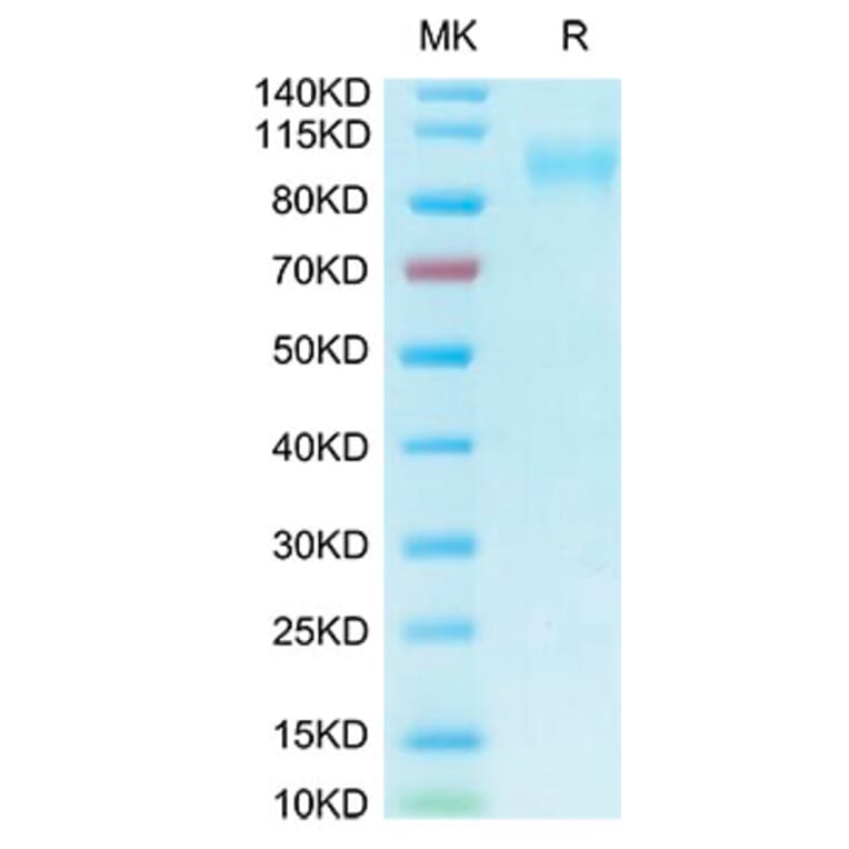Tris-Bis PAGE - Recombinant Human ACE2 Protein (Biotin) (C-terminal His and Avi Tag) (A330070) - Antibodies.com