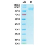 Tris-Bis PAGE - Recombinant Human ACE2 Protein (Biotin) (C-terminal His and Avi Tag) (A330070) - Antibodies.com