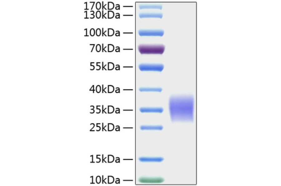 SDS-PAGE - Recombinant Human Activin Receptor Type IIA/ACVR2A Protein (C-terminal His Tag) (A330071) - Antibodies.com