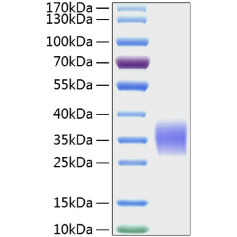 SDS-PAGE - Recombinant Human Activin Receptor Type IIA/ACVR2A Protein (C-terminal His Tag) (A330071) - Antibodies.com