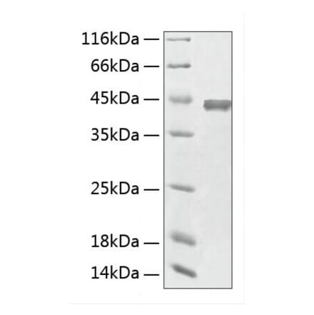 SDS-PAGE - Recombinant Human ACY1 Protein (C-terminal His Tag) (A330073) - Antibodies.com