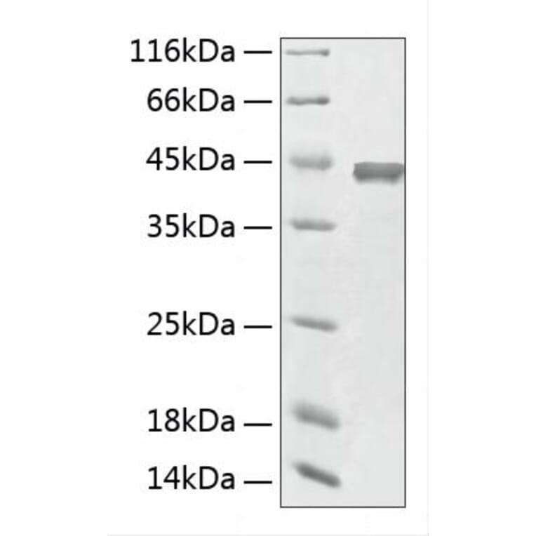 SDS-PAGE - Recombinant Human ACY1 Protein (C-terminal His Tag) (A330073) - Antibodies.com