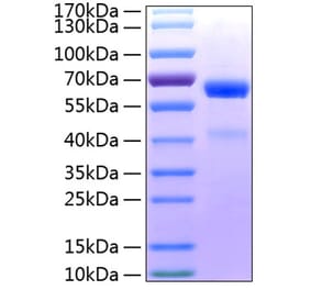 SDS-PAGE - Recombinant Human ADAM8 Protein (C-terminal His Tag) (A330074) - Antibodies.com