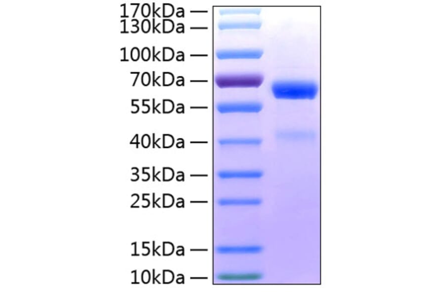 SDS-PAGE - Recombinant Human ADAM8 Protein (C-terminal His Tag) (A330074) - Antibodies.com