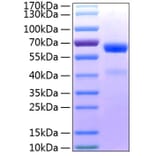 SDS-PAGE - Recombinant Human ADAM8 Protein (C-terminal His Tag) (A330074) - Antibodies.com