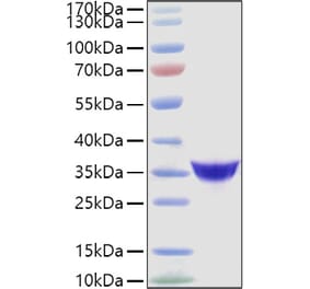 SDS-PAGE - Recombinant Human Adiponectin Protein (C-terminal His Tag) (A330075) - Antibodies.com