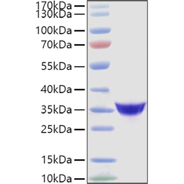 SDS-PAGE - Recombinant Human Adiponectin Protein (C-terminal His Tag) (A330075) - Antibodies.com