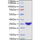 SDS-PAGE - Recombinant Human Adiponectin Protein (C-terminal His Tag) (A330075) - Antibodies.com