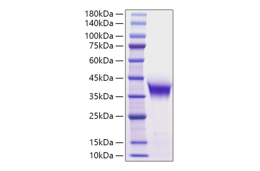 SDS-PAGE - Recombinant Human ADPRH Protein (N-terminal His Tag) (A330076) - Antibodies.com