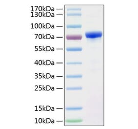 SDS-PAGE - Recombinant Human AFP Protein (C-terminal His Tag) (A330078) - Antibodies.com