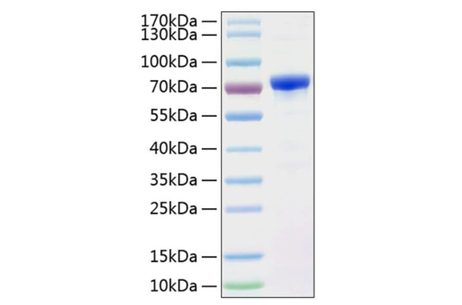 SDS-PAGE - Recombinant Human AFP Protein (C-terminal His Tag) (A330078) - Antibodies.com