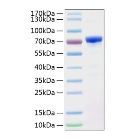 SDS-PAGE - Recombinant Human AFP Protein (C-terminal His Tag) (A330078) - Antibodies.com