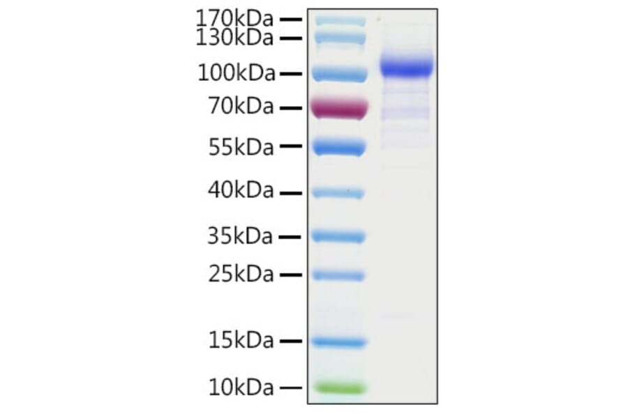 SDS-PAGE - Recombinant Human AGO1 Protein (N-terminal His Tag) (A330079) - Antibodies.com