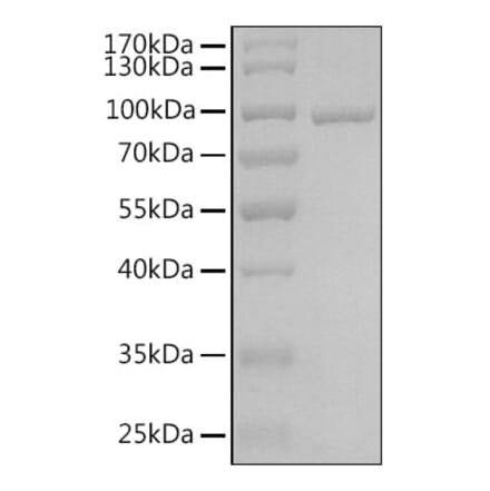 SDS-PAGE - Recombinant Human AGO3 Protein (N-terminal His Tag) (A330080) - Antibodies.com