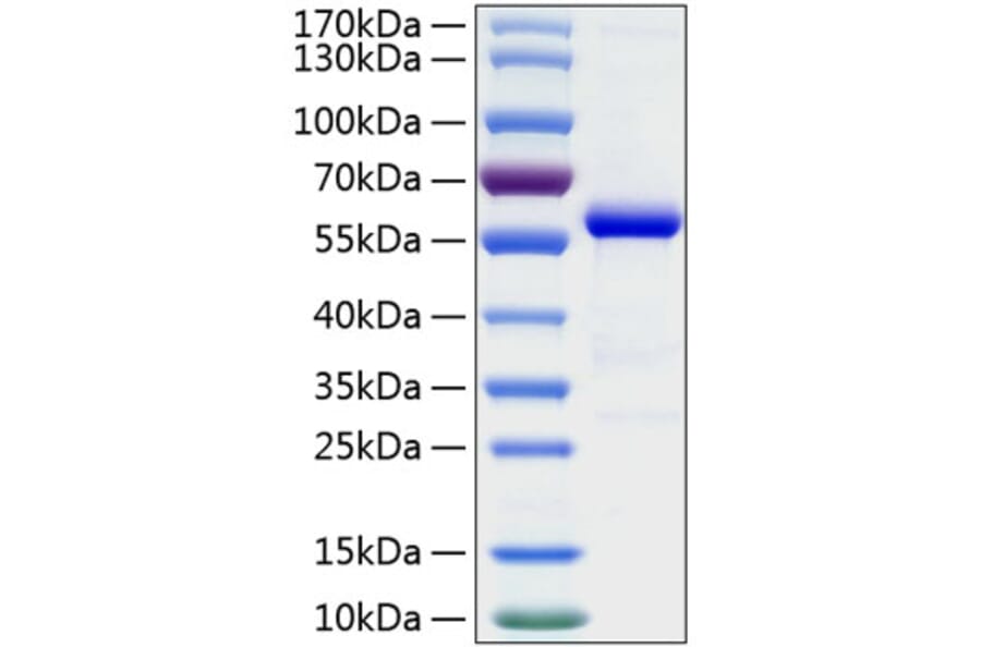 SDS-PAGE - Recombinant Human AL-1 Protein (C-terminal Human Fc and His Tag) (A330081) - Antibodies.com