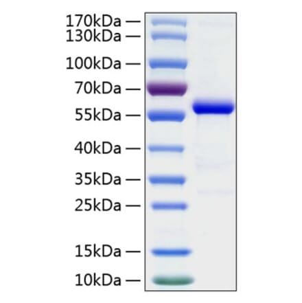 SDS-PAGE - Recombinant Human AL-1 Protein (C-terminal Human Fc and His Tag) (A330081) - Antibodies.com