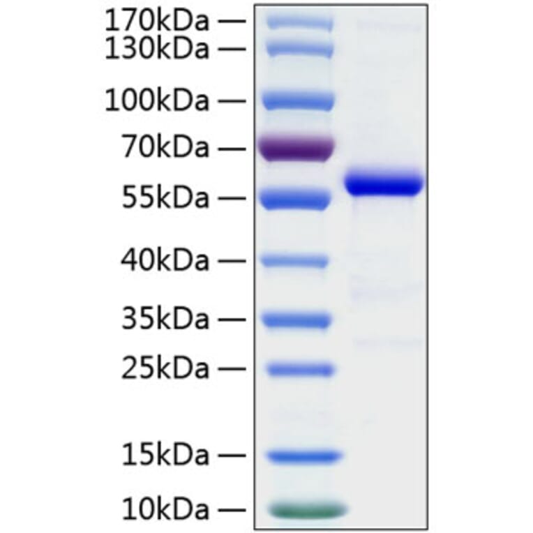 SDS-PAGE - Recombinant Human AL-1 Protein (C-terminal Human Fc and His Tag) (A330081) - Antibodies.com