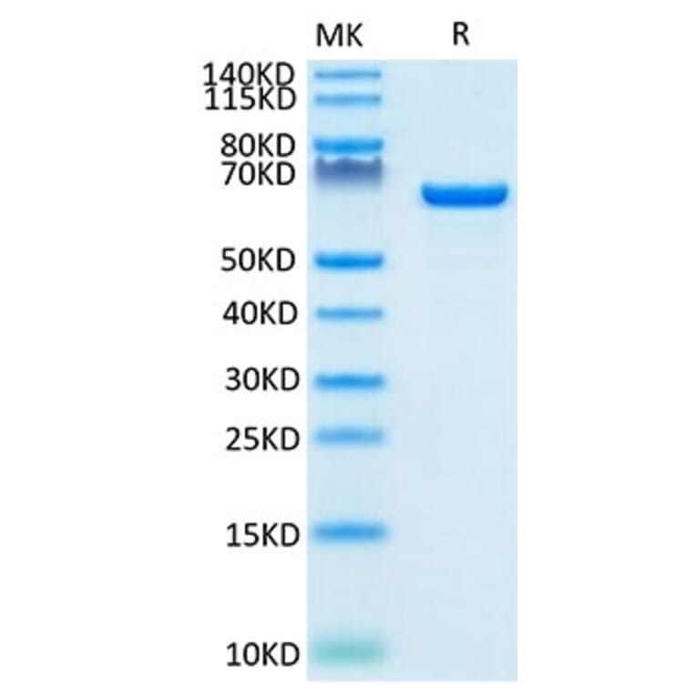 Tris-Bis PAGE - Recombinant Human Albumin Protein (Biotin) (C-terminal His and Avi Tag) (A330082) - Antibodies.com