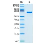 Tris-Bis PAGE - Recombinant Human Albumin Protein (Biotin) (C-terminal His and Avi Tag) (A330082) - Antibodies.com