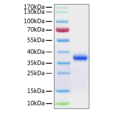 SDS-PAGE - Recombinant Human Aldose reductase Protein (N-terminal His Tag) (A330083) - Antibodies.com
