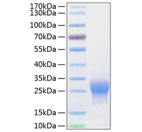 SDS-PAGE - Recombinant Human ALK-1 Protein (C-terminal His Tag) (A330084) - Antibodies.com