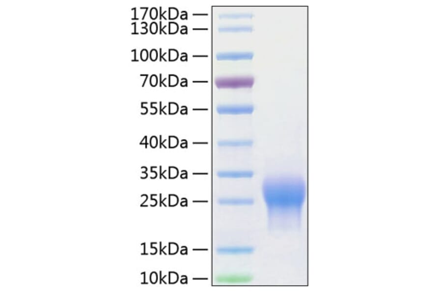 SDS-PAGE - Recombinant Human ALK-1 Protein (C-terminal His Tag) (A330084) - Antibodies.com