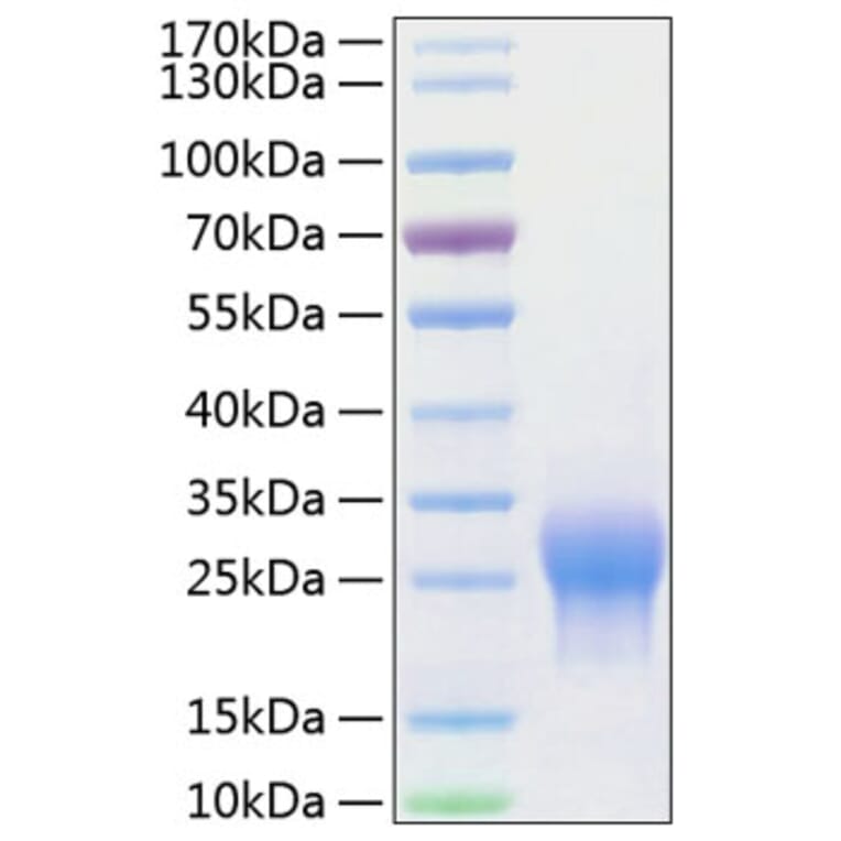 SDS-PAGE - Recombinant Human ALK-1 Protein (C-terminal His Tag) (A330084) - Antibodies.com