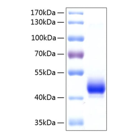 SDS-PAGE - Recombinant Human ALK-4 Protein (C-terminal Human Fc and His Tag) (A330085) - Antibodies.com