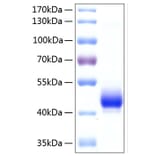 SDS-PAGE - Recombinant Human ALK-4 Protein (C-terminal Human Fc and His Tag) (A330085) - Antibodies.com