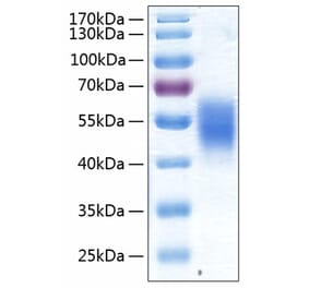 SDS-PAGE - Recombinant Human ALK-7 Protein (C-terminal Human Fc and His Tag) (A330086) - Antibodies.com