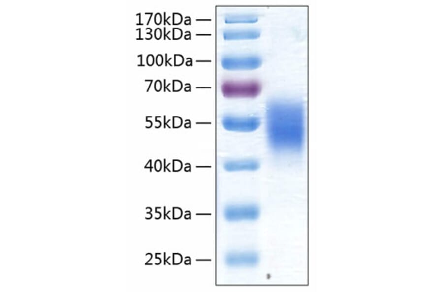 SDS-PAGE - Recombinant Human ALK-7 Protein (C-terminal Human Fc and His Tag) (A330086) - Antibodies.com