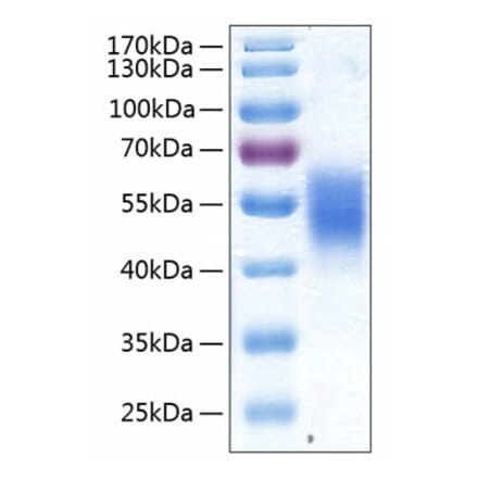SDS-PAGE - Recombinant Human ALK-7 Protein (C-terminal Human Fc and His Tag) (A330086) - Antibodies.com