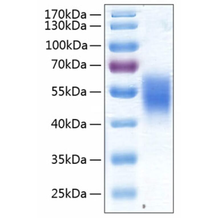 SDS-PAGE - Recombinant Human ALK-7 Protein (C-terminal Human Fc and His Tag) (A330086) - Antibodies.com