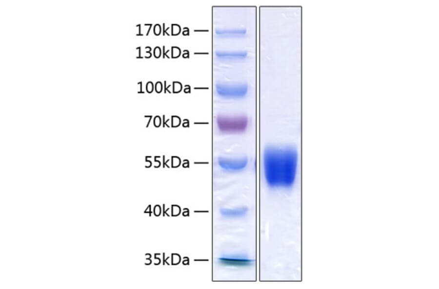 SDS-PAGE - Recombinant Human alpha 1 Antitrypsin Protein (C-terminal His Tag) (A330087) - Antibodies.com
