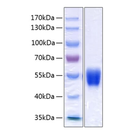SDS-PAGE - Recombinant Human alpha 1 Antitrypsin Protein (C-terminal His Tag) (A330087) - Antibodies.com