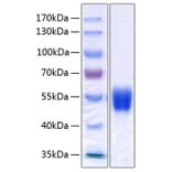 SDS-PAGE - Recombinant Human alpha 1 Antitrypsin Protein (C-terminal His Tag) (A330087) - Antibodies.com
