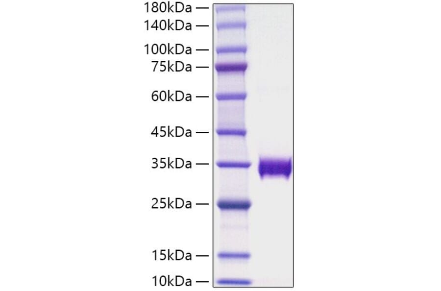 SDS-PAGE - Recombinant Human alpha 1 Microglobulin Protein (C-terminal His Tag) (A330088) - Antibodies.com