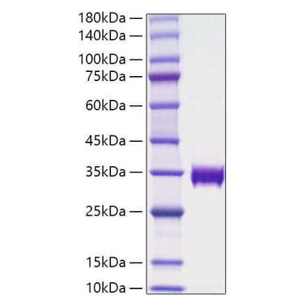 SDS-PAGE - Recombinant Human alpha 1 Microglobulin Protein (C-terminal His Tag) (A330088) - Antibodies.com