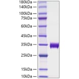 SDS-PAGE - Recombinant Human alpha 1 Microglobulin Protein (C-terminal His Tag) (A330088) - Antibodies.com