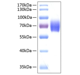 SDS-PAGE - Recombinant Human alpha 2 Antiplasmin Protein (C-terminal His Tag) (A330089) - Antibodies.com