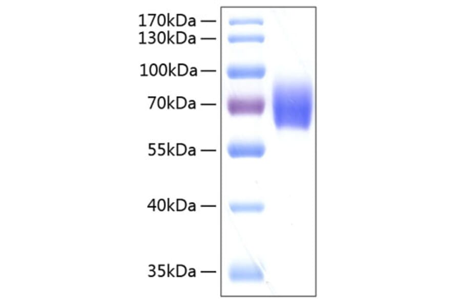 SDS-PAGE - Recombinant Human alpha 2 Antiplasmin Protein (C-terminal His Tag) (A330089) - Antibodies.com